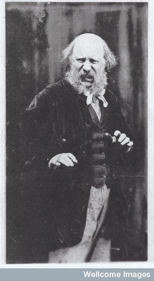 The expression of disgust, from Darwin's 1872 'The Expression of the Emotions' Credit: Wellcome Library, London.